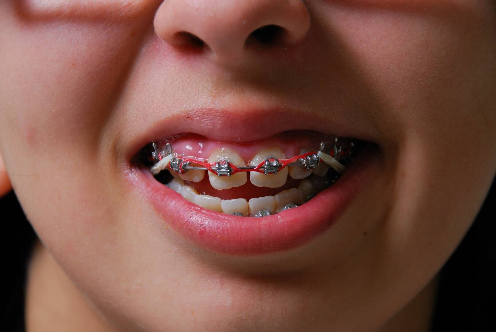 Dr. Jon Douglas Lesan, DDS, RpH, PA